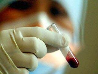 В области готовятся лечить холеру. Фото с сайта tlttimes.ru