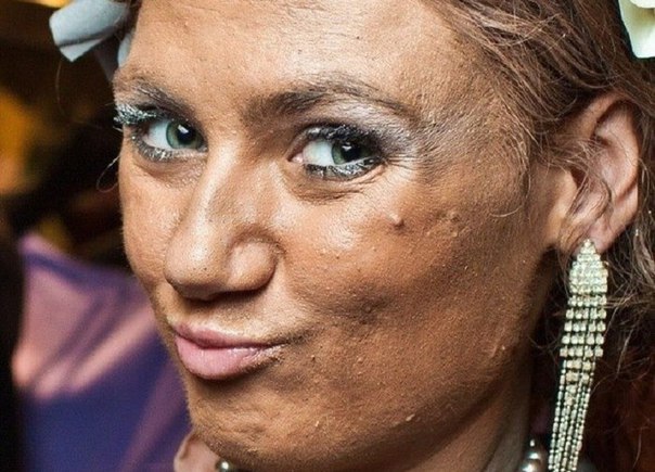 Новость - Досуг и еда - Страшнее ночи: ТОП-5 самых жутких последствий похода к косметологу в Днепре