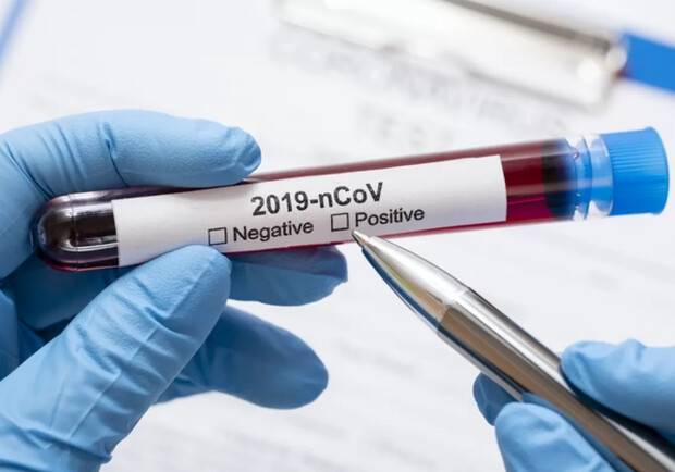 Не эффективны: Днепропетровщина отказывается закупать экспресс-тесты на коронавирус фото