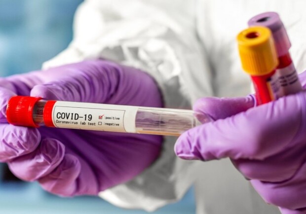 В Днепре готовы использовать новую тест-систему на коронавирус/ фото: unclinik.com.ua