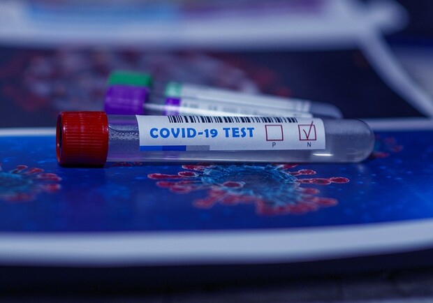 Динамика рспространения коронавируса в Днепре и области / фото: pixabay