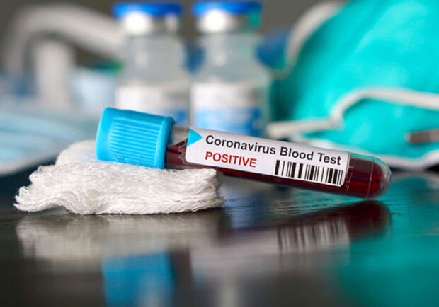 Сколько заболевших коронавирусом в Днепре 11-го июля/ фото: pinterest