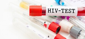 Завтра жители Полтавы смогут пройти бесплатную проверку на СПИД