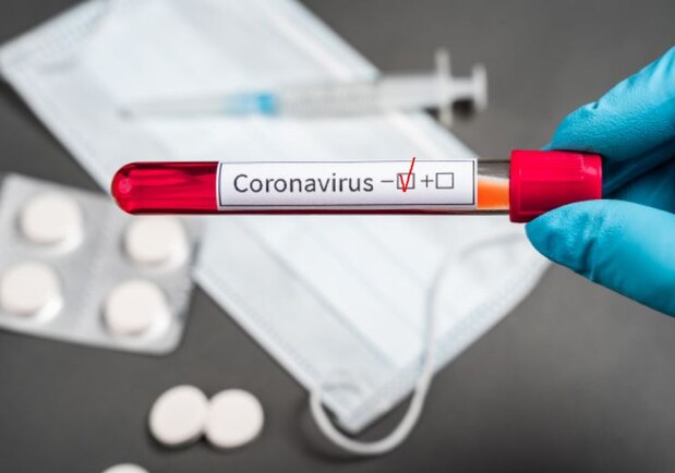 Какая ситуация с коронавирусом в Днепре на 4 февраля - фото: laboratoriounilab.com