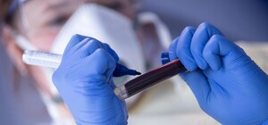 Узнай, болел ли: харьковчане могут бесплатно сделать анализ на антитела к коронавирусу