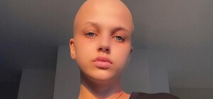 Победила рак: гимнастка Валерия Юзвяк возвращается в Украину