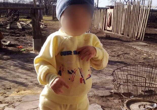 "Умер" мозг: что сейчас 2-летний малышом, которого порезал отчим - фото ermolinskiy_news