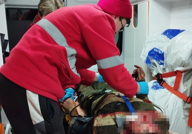 Лікарі розповіли, у якому стані постраждалі внаслідок вибуху гранати у Кам’янському 