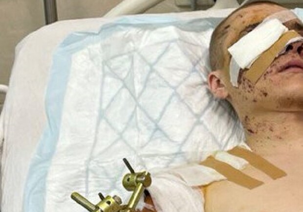 Обломки пробили глаз и повредили череп: в Днепре спасают бойца, получившего тяжелые ранения - 