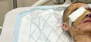 Уламки пробили око та пошкодили череп: у Дніпрі рятують бійця, який отримав важкі поранення