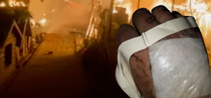 В Запорожье подожгли приют на Бабурке: собаки сгорели заживо