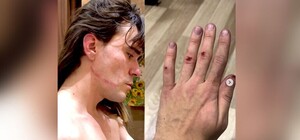 Первое преступление гомофобной ненависти в 2025-м: в Киеве неизвестный избил художника Даниэля Скрипника