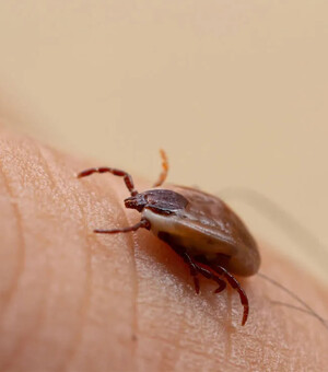 Як безпечно витягнути кліща: покрокова інструкція, профілактика та поради