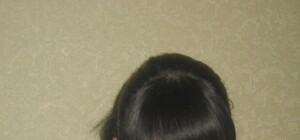 Девушка, впавшая в кому после родов, поставила на уши весь интернет Донецка