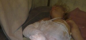 Врачи, которые проводили вскрытие Оксаны Макар, в шоке: легкие девушки будто каменные