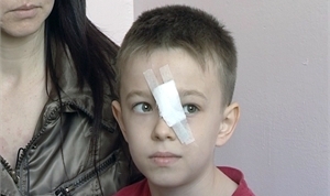 Жертве второго обстрела - 9-летнему Илье - пуля лишь чудом не задела глаз. Фото автора