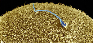 Бездетным запорожцам помогут завести малыша с помощью микроскопа