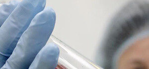 У Львові безкоштовно обстежать на  ВІЛ, сифіліс та вірусні гепатити