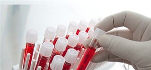 Будь в курсі: у львівських 