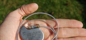 Безкоштовно: у Львові пацієнтам ставлять дорогі кардіостимулятори