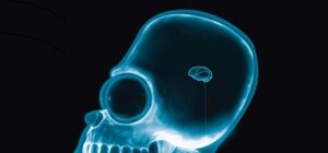 Где на этих выходных можно бесплатно сделать флюорографию. Адреса