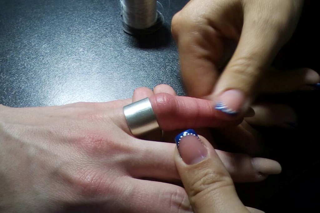 Как снять кольцо с опухшего пальца видео. Как снять кольцо с отекшего пальца. Способы снятия кольца с опухшего пальца.