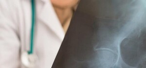 Где в январе в Киеве можно бесплатно пройти флюорографию. Адреса