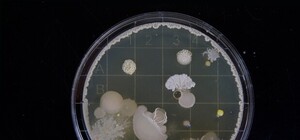 Не грипом єдиним: які небезпечні віруси можна підчепити у Львові цієї зими