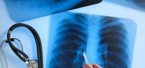 Просветись: адреса, где в Киеве можно бесплатно пройти обследование флюорографа