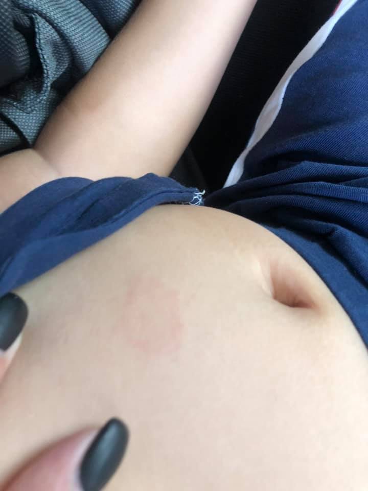 Такое пятно появилось спустя месяц / фото: fb Яна Демченко&lrm; ж/м Сокіл, м. Дніпро