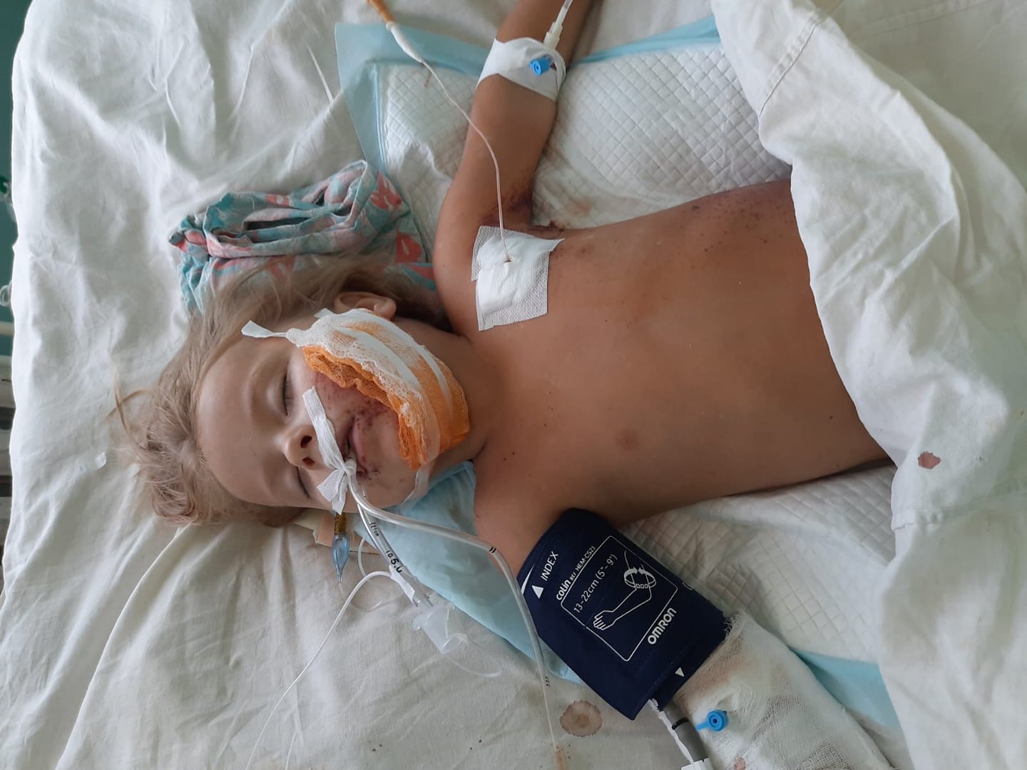 Поступила Вероничка в тяжелом состоянии / фото: @fond.gerda