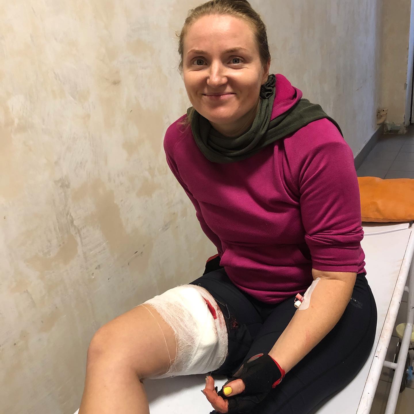 У пострадавшей серьезная рана на ноге, которую зашивали / фото: fb Уляна Рожко