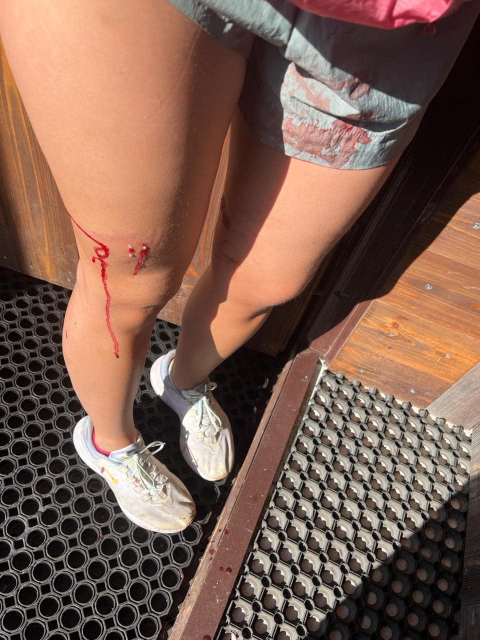 Постраждала дівчинка –