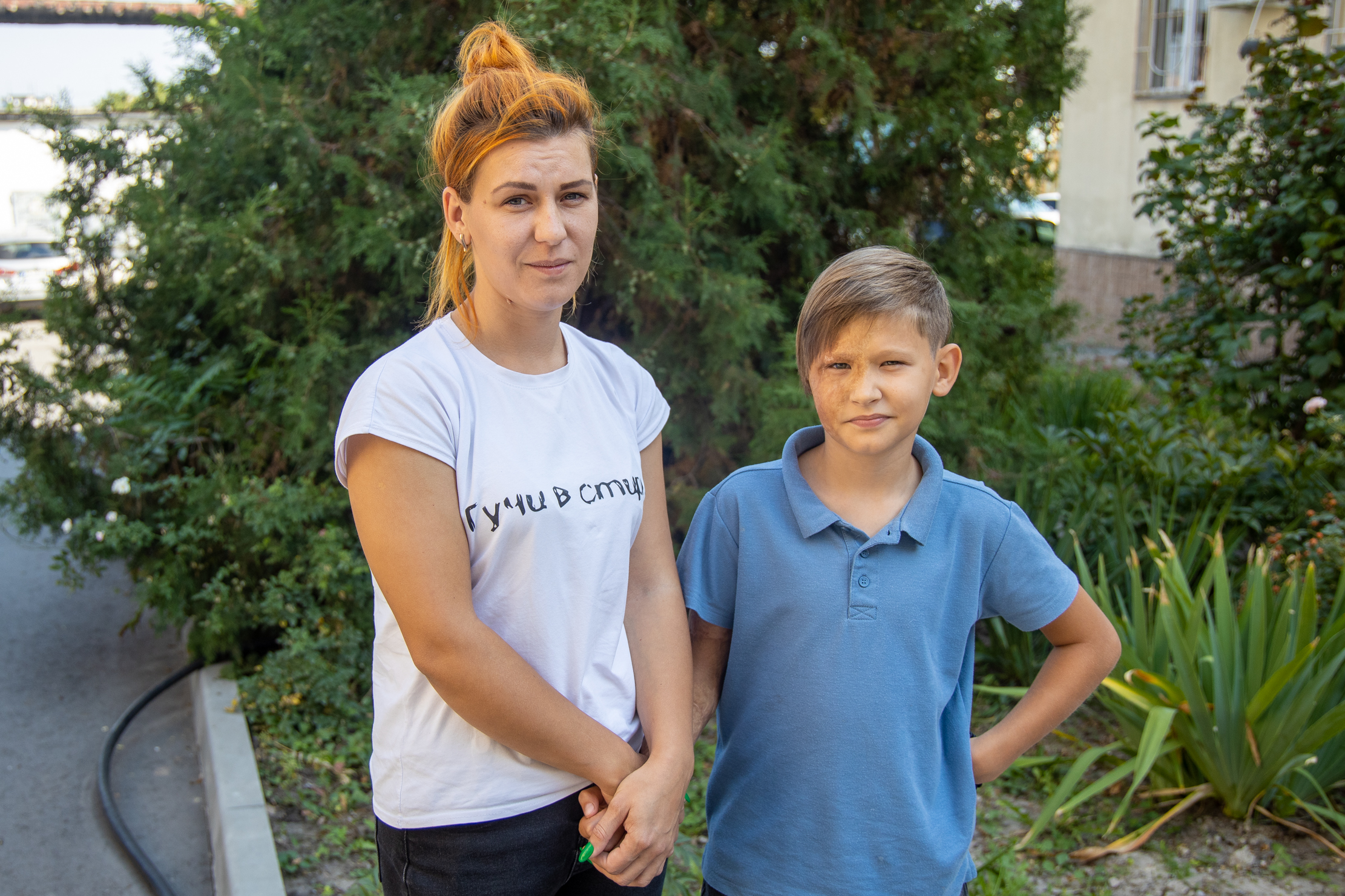 На Днепропетровщине американские врачи помогают оперировать детей с ожогами фото 7 6