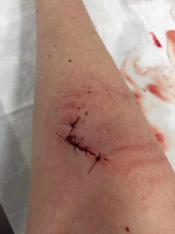 Днепрянке пришлось зашивать глубокую рану в ветклинике: узнай, почему фото 1