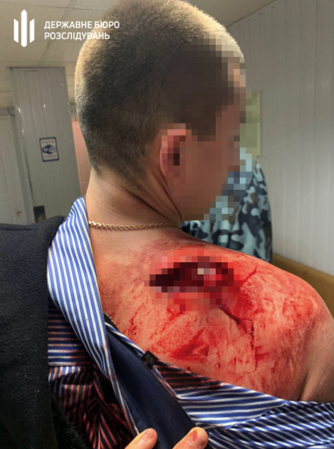 Пострадавший охранник / фото: ГБР