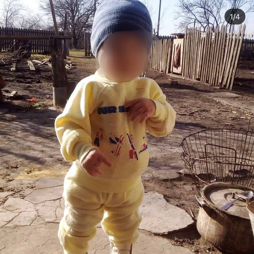 За жизнь этого малыша борются врачи / фото: @ermolinskiy_news