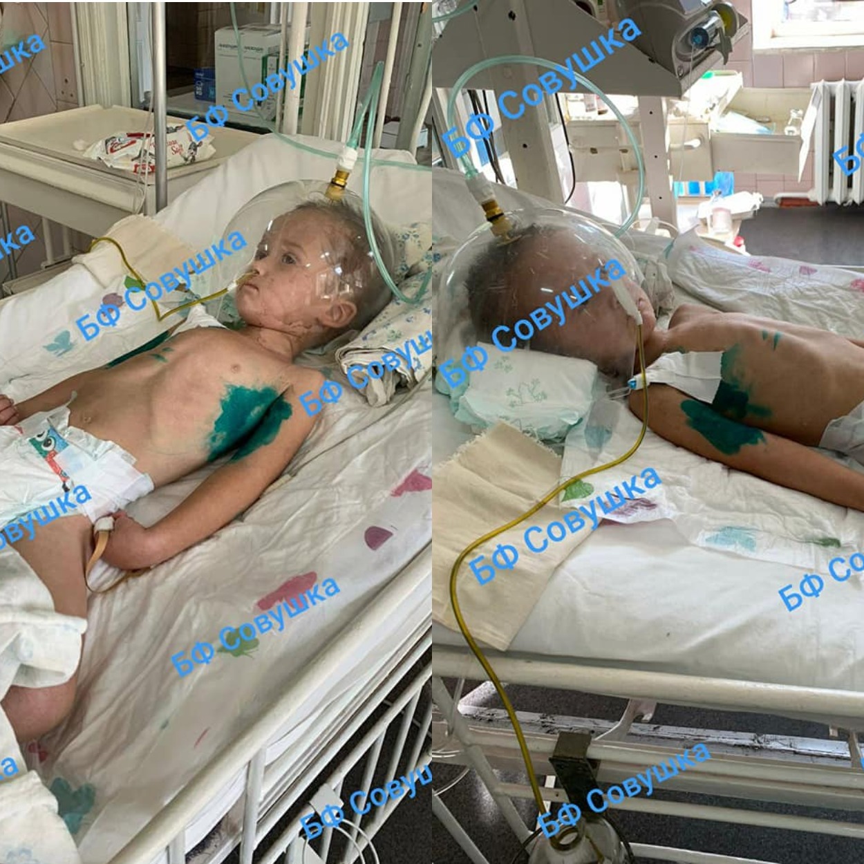 Маленький Захар в коме 2-й степени/ фото: fb Александры Совы-Тимощенковой