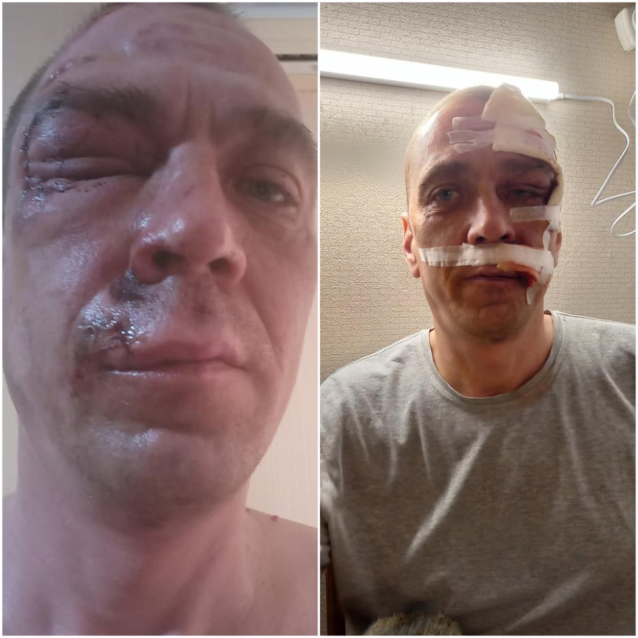 Мужчина, которого побили/ фото: fb Елены Берелет