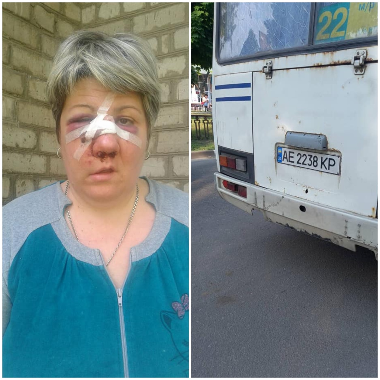 Так выглядела пострадавшая/ фото: fb Инны Росличенко 