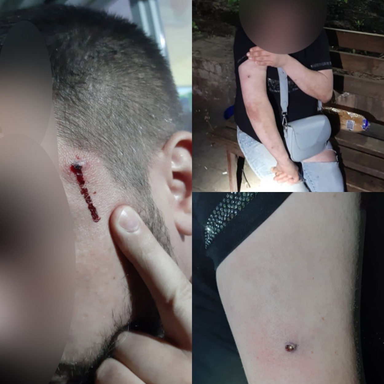 Пострадавшие от стрельбы на Тополе-2/ фото: dnepr.info