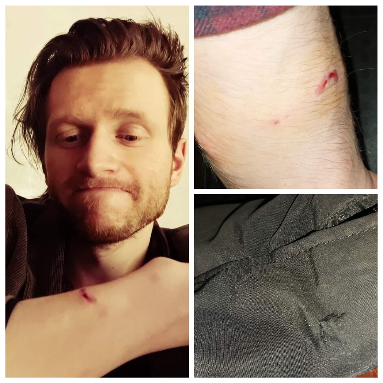 В Днепре возле "Терры" мужчину укусила собака/ фото: fb Dmitry Vishnivet (Шевченковский район-Правый берег Днепр)