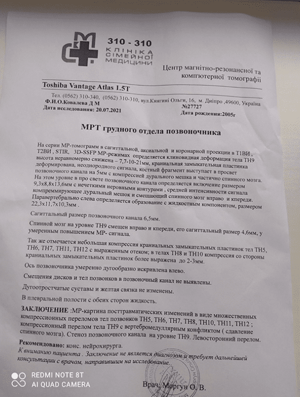 Результат МРТ позвоночника Дарьи Ковалевой/ фото: НМ