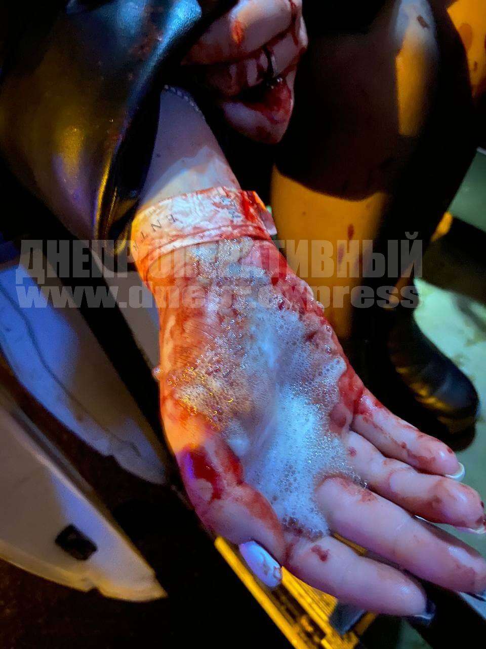 Травма руки/ фото: Днепр Оперативный