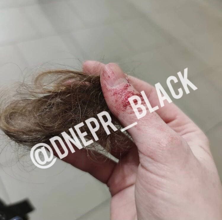 Клок волос девушки/ фото: tg Dnepr_Black