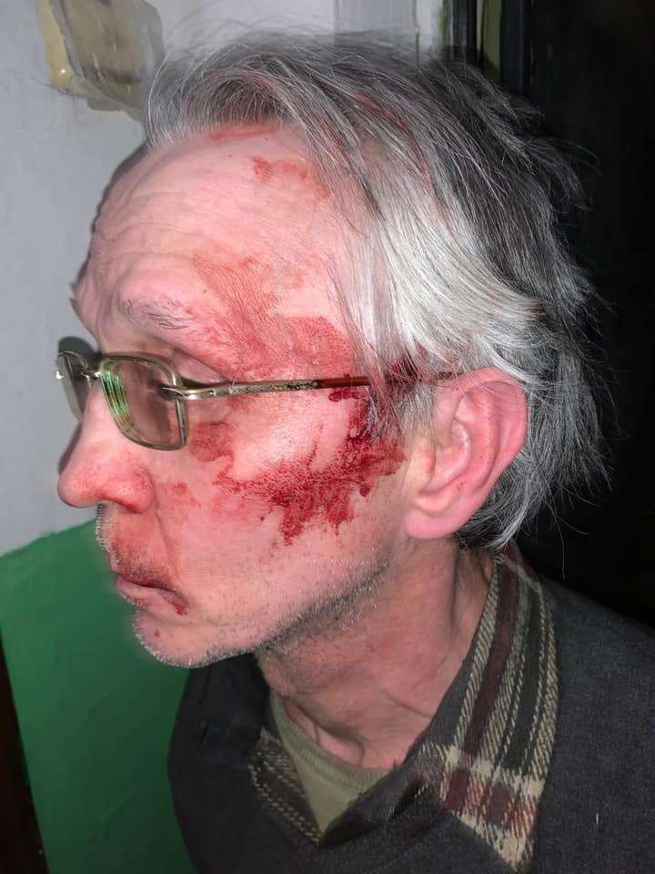 Пенсионер с разбитой головой/ фото: Днепр Оперативный