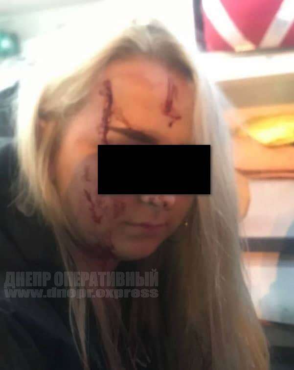 Пассажирка, которая пострадала в ДТП на Рабочей/ фото: Днепр Оперативный