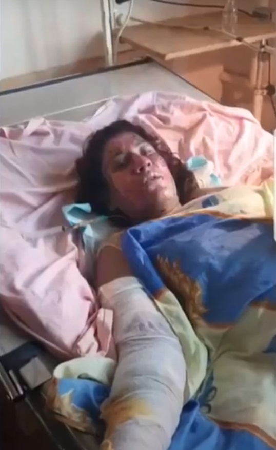 Пострадавшая в больнице/ фото: ICTV