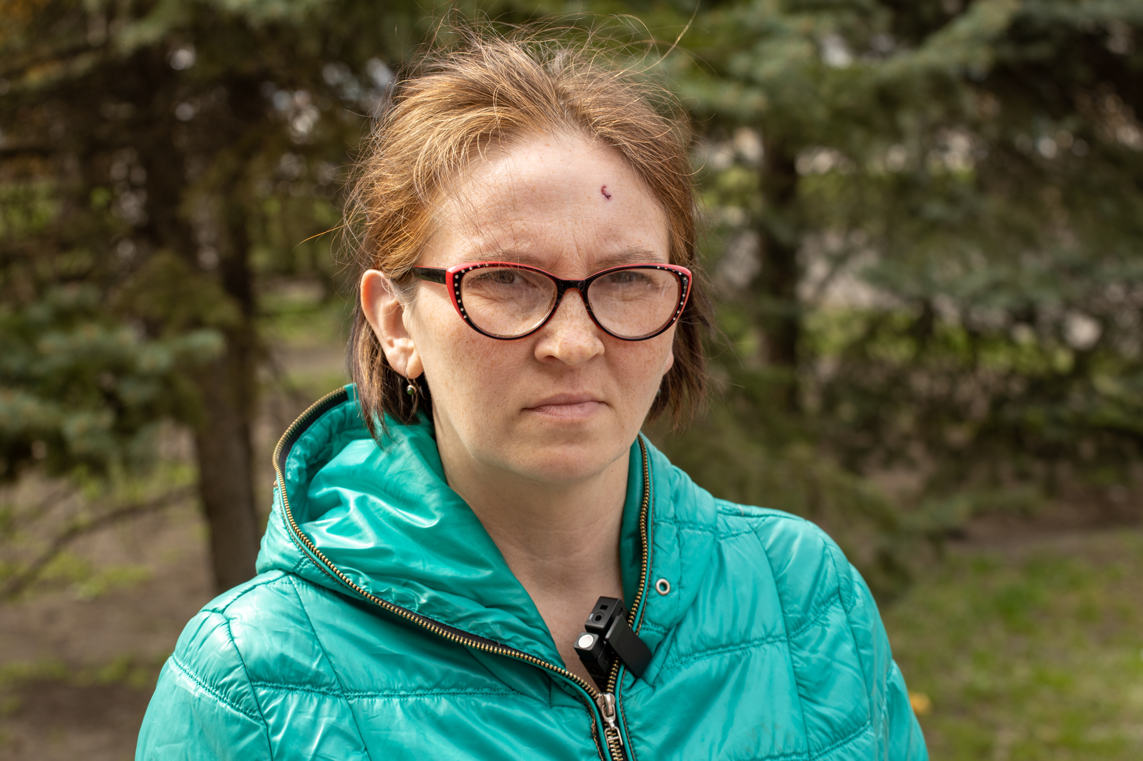 Мама пострадавшего в Краматорске ребенка.