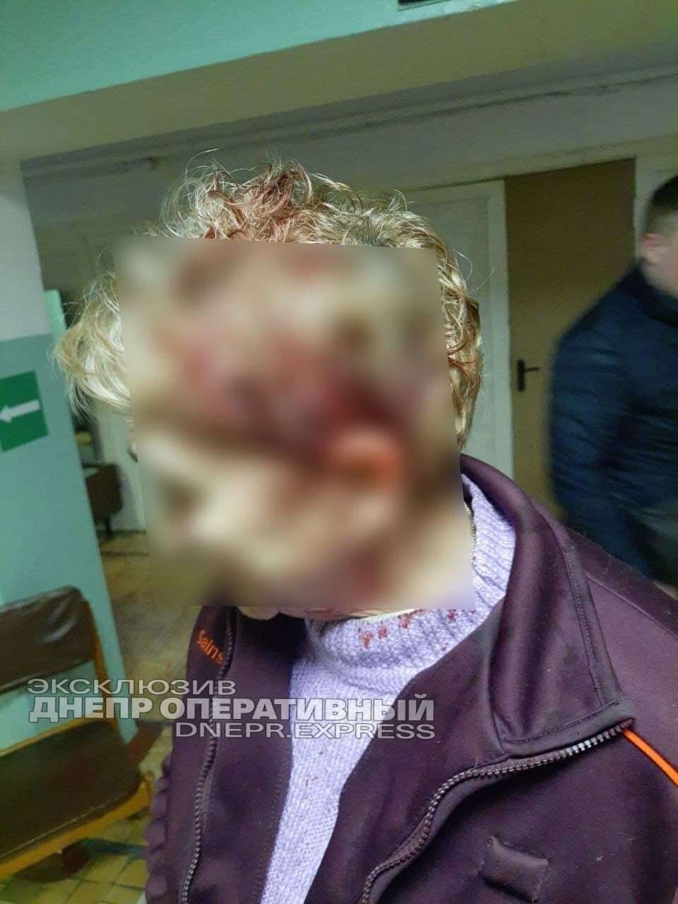 Голова вахтерши была в крови.